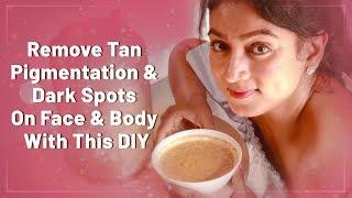 Remove Tan Pigmentation And Dark Spots On Face And Body With This DIY || Aftercare Tips || Ashtrixx