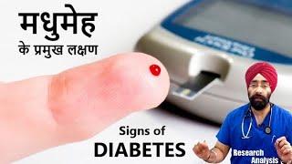 मधुमेह के ३ बड़े लक्षण  | Top 3 Symptoms of Diabetes | Dr.Education Hindi Eng