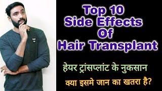 Top 10 Side Effects of Hair Transplant | क्या Hair Transplant मे जान भी जा सकती हैं