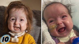 2 Year Old Girl Is The Only Person With Benjamin Button Disease