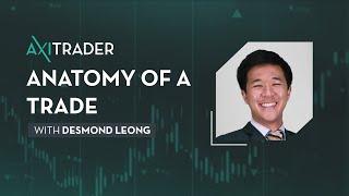 Trade Management: Anatomy of a trade