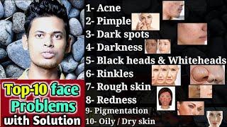 Top-10 skin problem and it's solution // acne,pimple,dark spots, darkness,rinkle, rough skin,redness