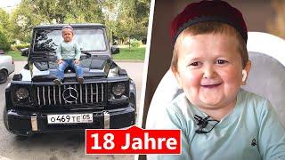 Dieser 18-JÄHRIGE Internet-Star ist gefangen im Körper eines Kindes