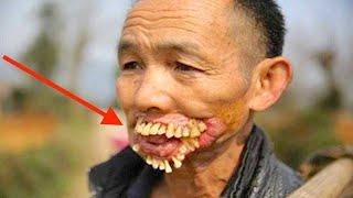 Top 10 Oddest Dental Cases