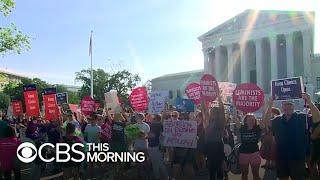 Conservative-leaning Supreme Court to hear major abortion case
