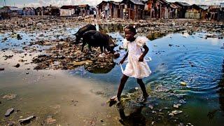 TOP 10 WORLDS POOREST COUNTRY