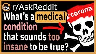 What's a medical condition that sounds too Insane to be true? - (r/AskReddit)