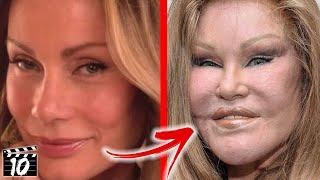 Top 10 Celebrities With Terrible Plastic Surgery - Part 2