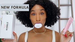 HiSmile's New Teeth Whitening Formula | Before & After Results