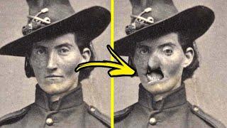 Top 10 Messed Up Things In The Life of A Civil War Soldier