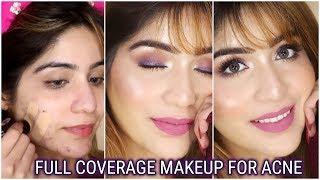 FULL Coverage Glam Makeup For Acne Prone Skin ||Using SUGAR COSMETICS Products