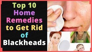 Top 10 Home Remedies to Get Rid of Blackheads