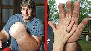 10 People With Unusual Body Parts