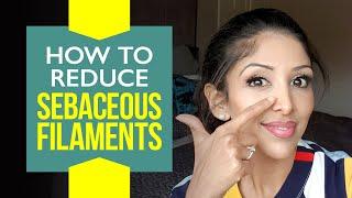 SEBACEOUS FILAMENTS by DOCTOR V| Brown/ Dark Skin of Colour| Dr V|