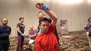 MostAmazingTop10 - Case : FROZEN SHOULDER 五十肩Master Chris Leong CLM Tit Tar for him 马来西亚 梁潤江跌打師傅