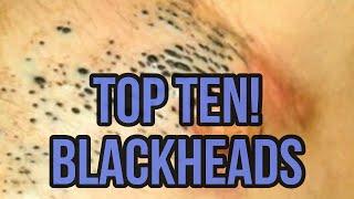 Top 10 Most Popular Blackhead, Blemish, and Skin Related Search Terms