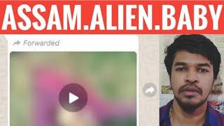 Assam Alien Baby Explained | Tamil