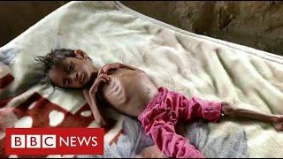 Millions of children face starvation in Yemen warns United Nations - BBC News