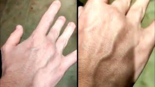 Man That Can Move His Veins