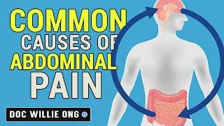 Common Causes of Stomach Pain - Dr Wilie Ong Health Blog #39b