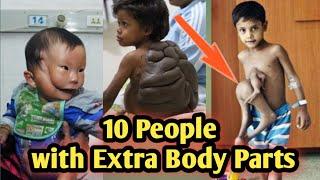 #VIRAL TOP 10 People with Extra Body Parts