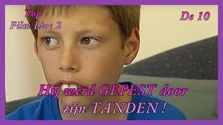 Hij werd gepest door zijn TANDEN !   { Top film live }