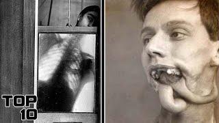 Top 10 Dark Treatments Doctors Used In History