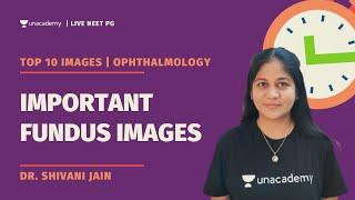 Top 10 expected Important Fundus Images | Ophthalmology | Dr. Shivani Jain