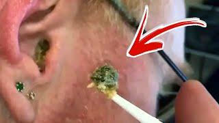 Top 10 Ear Wax Removal Video Compilation