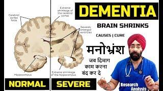 Why Brain Slows Down & Shrinks | Understand Dementia | मनोभ्रंश | Dr.Education (Hindi + Eng)