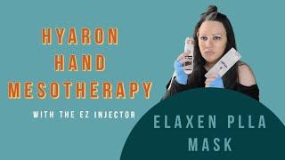 Crepey Skin Top of Hand Mesotherapy (Meso) with Hyaron & EZ injector - Elaxen PLLA Mask - Round 4