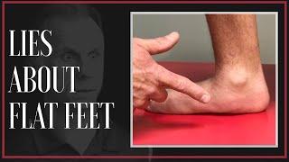 The Big Lie About Flat Feet & Custom Arch Support! (Updated)