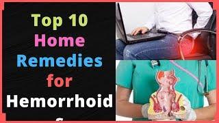 Top 10 Home Remedies for Hemorrhoids