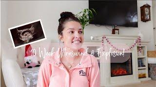 10 Week Ultrasound & Explosion!