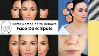 Remove Face Dark Spots: Top 12 Home Remedies