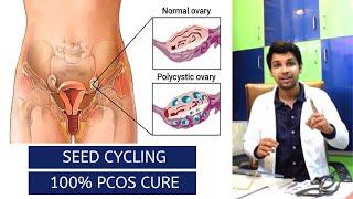 Seed Cycling To Cure PCOS / PCOD Problem Permanently & Naturally Get Pregnant in One Month | JYOVIS