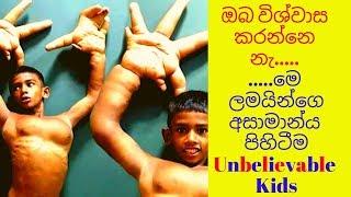 ඇග කිලිපොලා යන මේ ලමයින්ගේ පිහිටීම්/10 Kids You Wont Believe Actually Exist