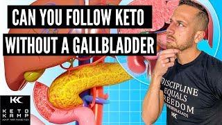 How to Follow The Keto Diet Without a Gallbladder (5 Easy Steps)