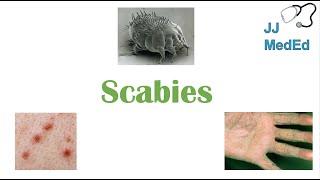 Scabies (Skin Condition) | What Is It, Classic vs. Crusted Types, Signs & Symptoms, Treatment