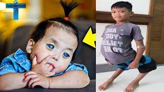 Top 10 Unusual And Amazing Kids Around The World You Won't Believe Exist