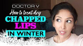 Doctor V - How To Treat Chapped Lips In Winter | Brown/ Black skin | Skin of colour | DRY LIPS