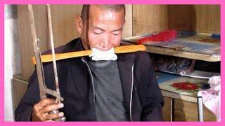 Top 10 Unbelievable Cases Of Self-Amputation For Survival
