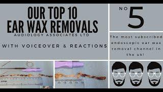 TOP 10 EAR WAX REMOVAL VIDEOS - NUMBER 5