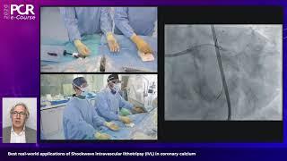 Best real-world applications of Shockwave IVL in coronary calcium - PCR e-Course 2020