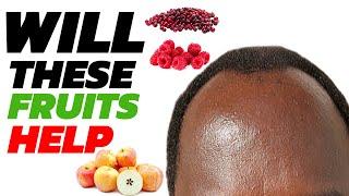 Top 10 Fruits For Men’s Hair Growth | Receding Hair Line & Thinning Hair