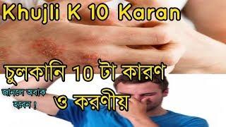 Chulkanir top 10 point karon o koronio  Bengali || Khujli Swami || Natural Allergy Remedies