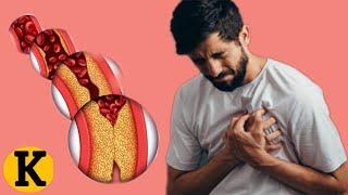 Top 10 Artery Cleaning Food |Thise Food CLean Your Arteries & Can Prevent A Heart Attack