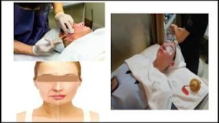 Thread Lifting in Korea Minimal Invasive, Maximum Results!