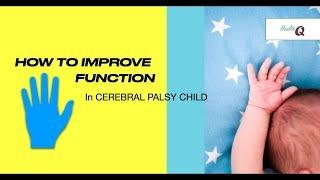 TOP TIPS TO IMPROVE HAND FUNCTION IN CEREBRAL PALSY