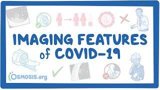 Imaging Features of COVID-19